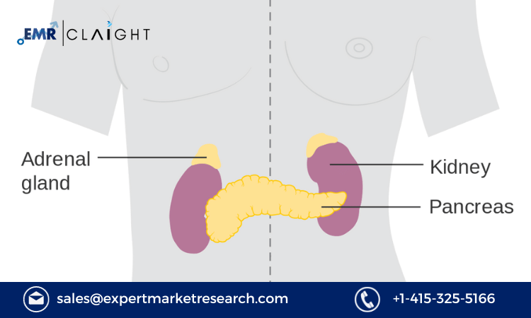 Read more about the article Global Adrenal Crisis Treatment Market Size to Grow at a CAGR of 5.4% in the Forecast Period of 2023-2031