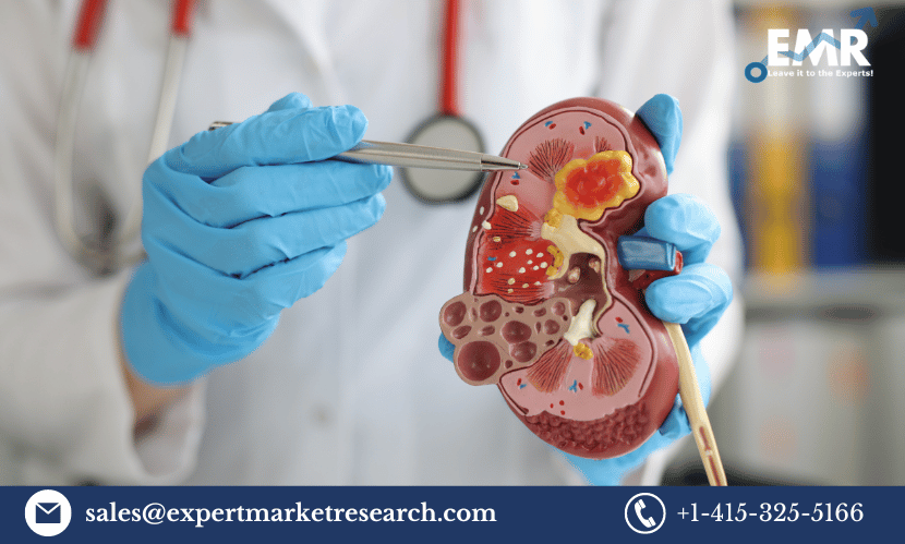 Read more about the article Gaucher’s Disease Treatment Market Size to Grow at a CAGR of 3.6% in the Forecast Period of 2023-2031