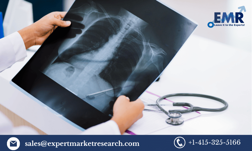 Read more about the article Medical X-ray Market Size, Report, Share, Key Players, Growth, Trends, Forecast 2024-2032