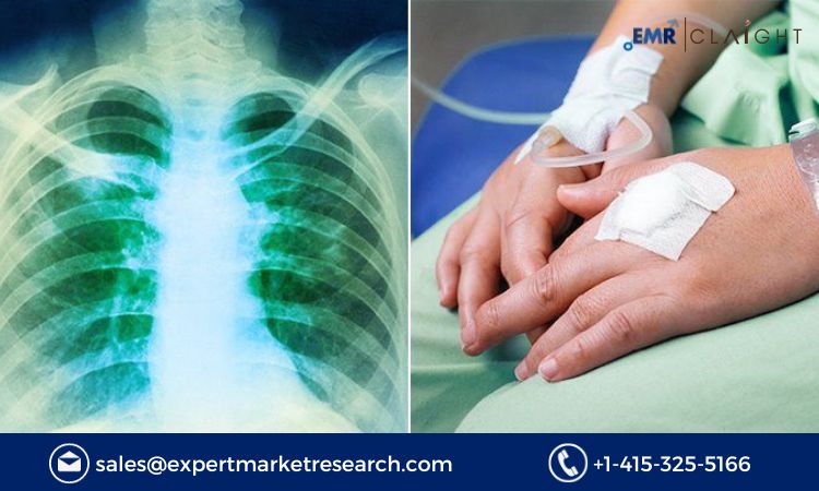 Read more about the article Non-Hodgkin’s Lymphoma Treatment Market Size to Grow at a CAGR of 7.2% in the Forecast Period of 2023-2031