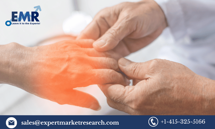 Read more about the article Global Peripheral Neuropathy Treatment Market Size to Grow at a CAGR of 3.7% in the Forecast Period of 2023-2031