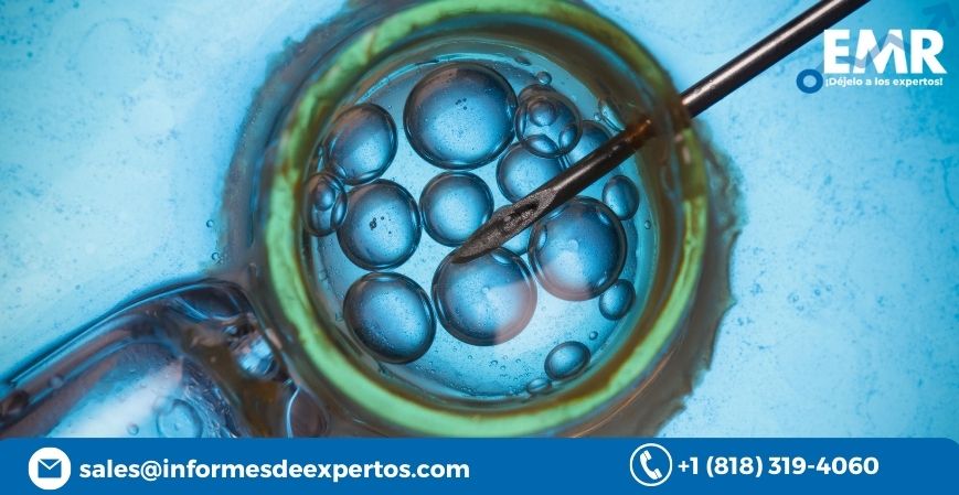 Read more about the article Mercado de Tecnología de Reproducción Asistida Ganaría Impulso Debido a Técnicas Avanzadas como la Congelación de Óvulos y el Banco de Esperma, Durante el Período de Pronóstico de 2023-2028