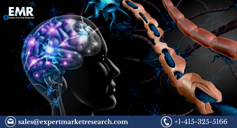 Read more about the article Multiple Sclerosis Treatment Market Size to Grow at a CAGR of 6% in the Forecast Period of 2024-2032