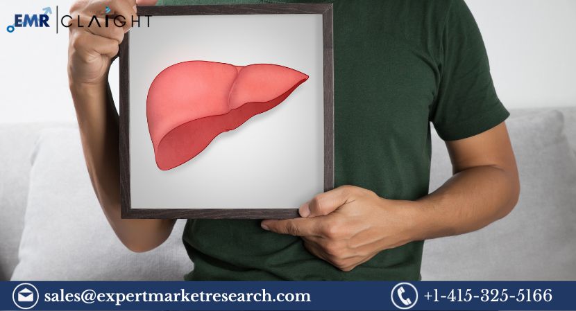 Read more about the article Global Non-Alcoholic Steatohepatitis (NASH) Treatment Market Size to Grow at a CAGR of 5.7% in the Forecast Period of 2024-2032