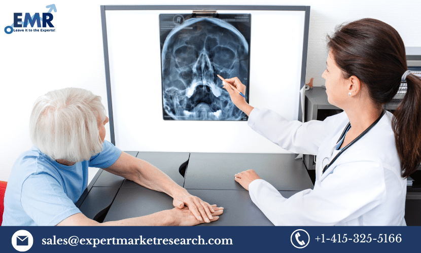 Read more about the article Global Sinusitis Treatment Market Size, Share, Growth, Industry, Report and Forecast 2024-2032