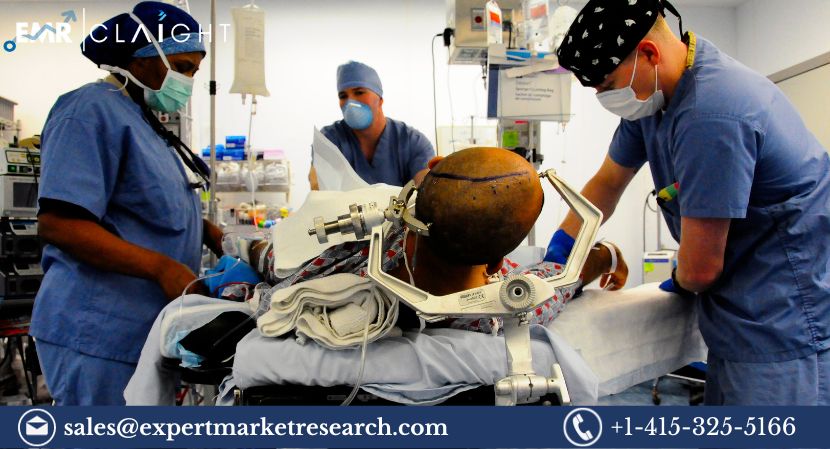 Read more about the article Global Brain Tumor Treatment Market Size to Grow at a CAGR of 10.9% in the Forecast Period of 2024-2032