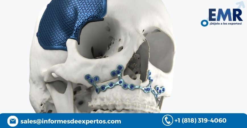 Read more about the article Mercado de Implantes Craneomaxilofaciales Proliferará Debido al Creciente Número de Lesiones Faciales y Craneales Durante el Período de Pronóstico de 2023-2028