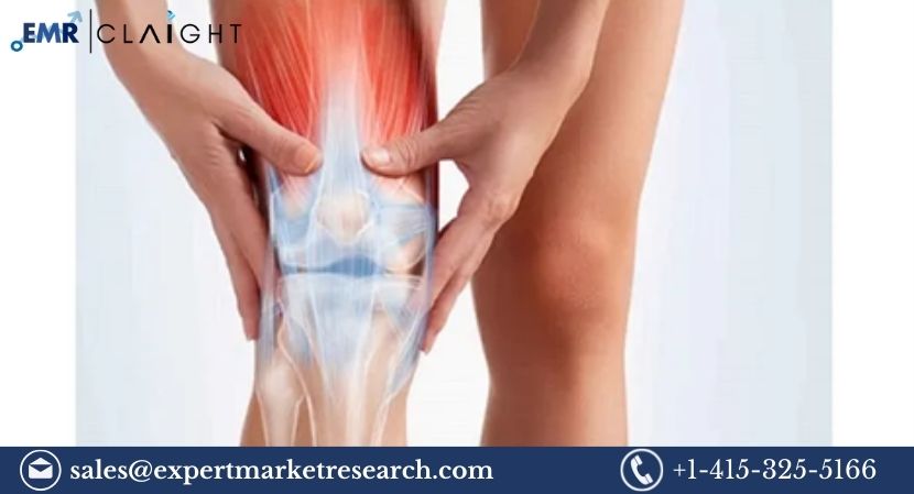 Read more about the article Global Meniscus Repair Systems Market Size To Grow At A CAGR Of 8.7% In The Forecast Period Of 2024-2032