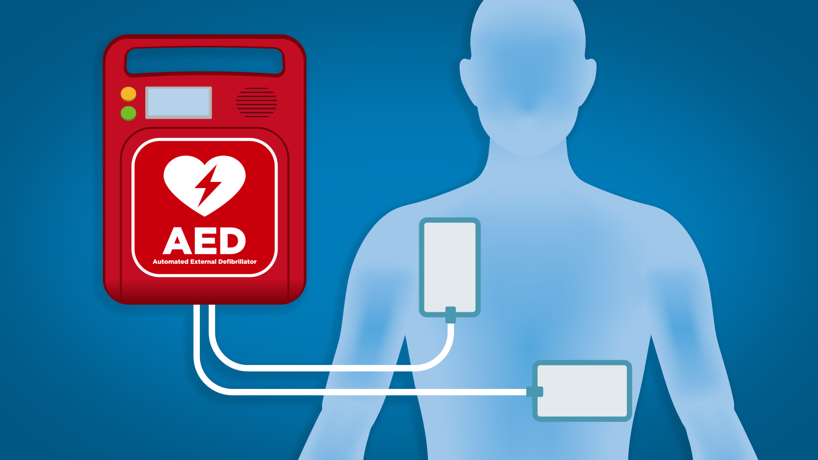 Read more about the article Global External Defibrillator Market Size, Share, Price, Trends, Report and Forecast 2024-2032