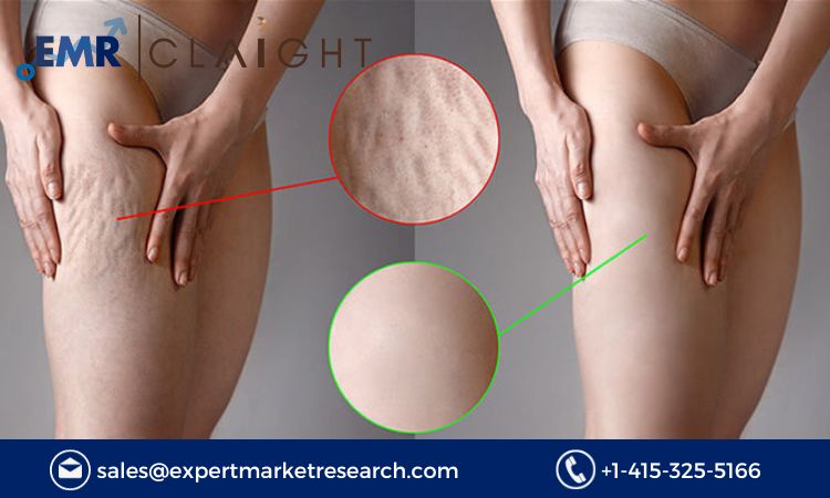 Read more about the article Cellulite Treatment Market Share, Size, Price, Trends, Analysis, Report and Forecast 2024-2032