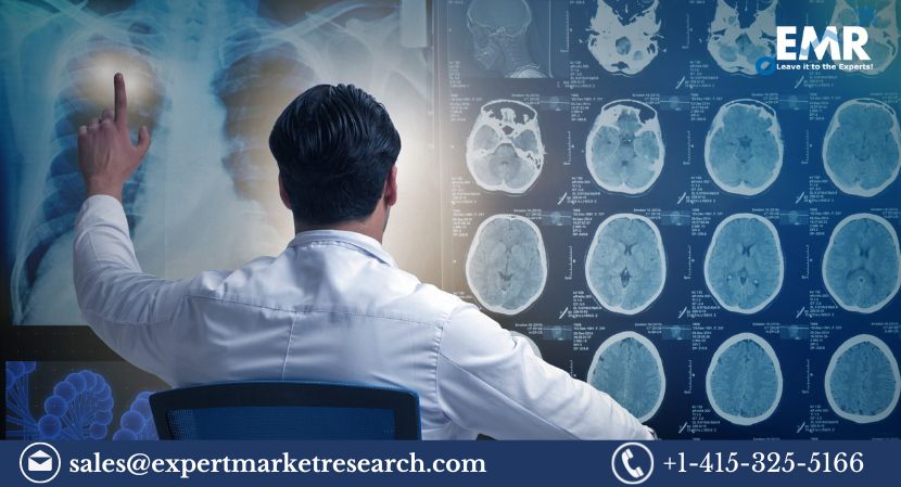 Read more about the article Clinical Trial Imaging Market Size, Share, Price, Report and Forecast 2023-2031