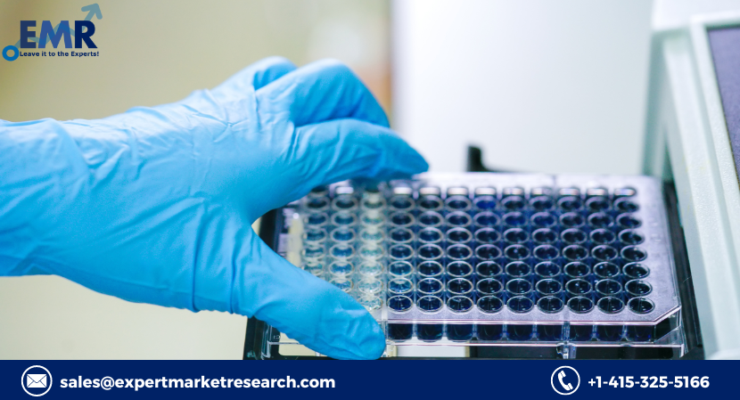 Read more about the article Enzyme-Linked Immunosorbent Assays (ELISAs) Market Size, Price, Growth, Report, Forecast 2024-2032