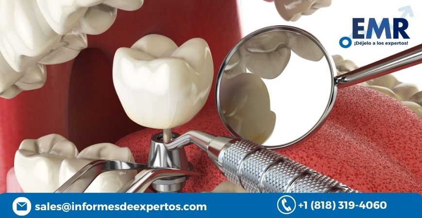 Read more about the article Mercado de Implantes Dentales Incrementará en 2023-2028 Estimulado por Mayor Concienciación sobre la Salud Bucodental y Utilización de Tecnología Moderna en las Clínicas Dentales