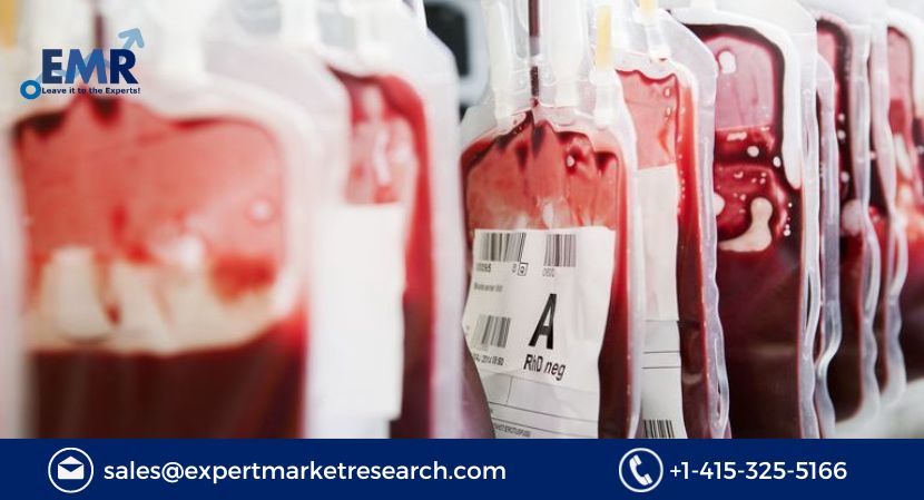 Read more about the article Global Blood Group Typing Market Size, Share, Report and Forecast 2023-2028