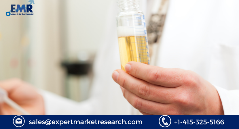 Read more about the article Global Fermentation Chemicals Market Size to Grow at a CAGR of 6.80% in the Forecast Period of 2023-2028