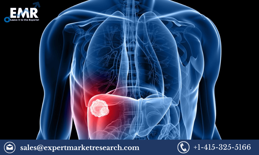 Read more about the article Global Liver Cancer Screening Market Size, Share, Growth, Trends, Analysis, Research Report and Forecast 2023-2028