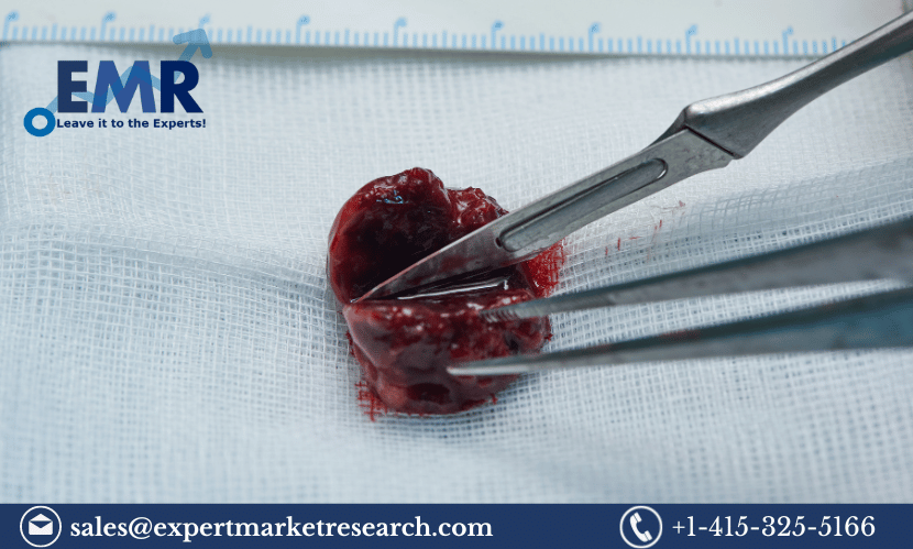 Read more about the article Global Surgical Blade Market Size To Grow At A CAGR Of 4.50% In The Forecast Period Of 2024-2032