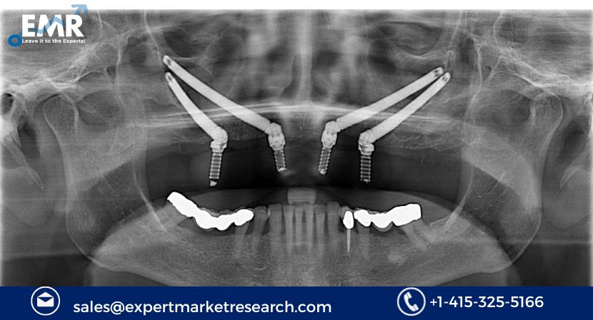 Read more about the article Global Zygomatic and Pterygoid Implants Market Size, Share, Price, Trends, Growth, Report and Forecast 2024-2032