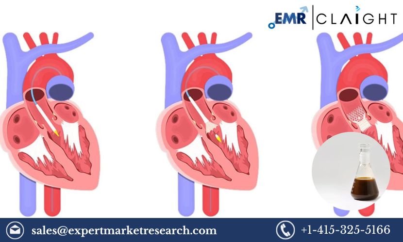 Read more about the article Aortic Valve Replacement Market Size, Share, Price, Trends, Growth, Analysis, Report and Forecast 2024-2032