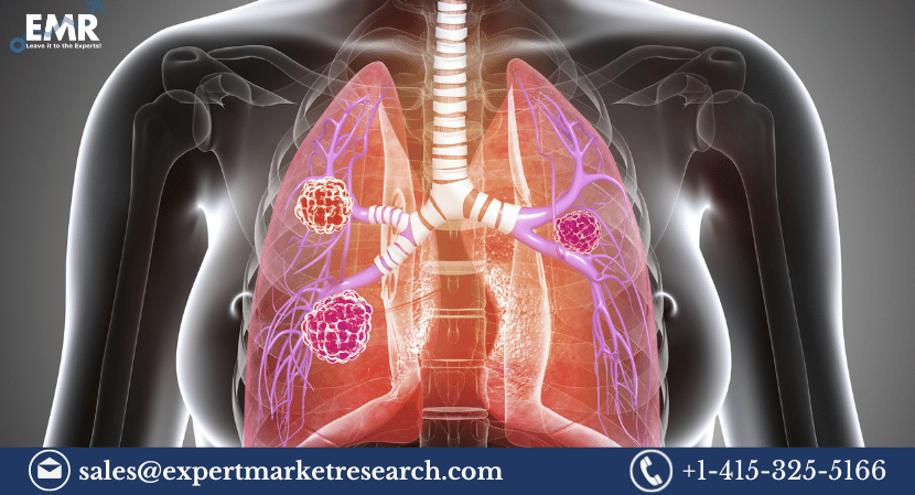 You are currently viewing Global Cancer/Tumour Profiling Market Size to Grow at a CAGR of 10.2% in the Forecast Period of 2024-2032