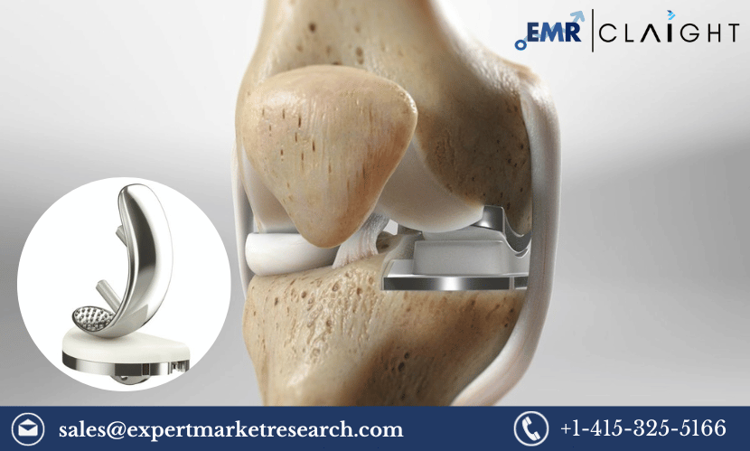 Read more about the article Global Unicompartmental Knee Prostheses Market Share, Size, Trends, Price, Analysis, Outlook, Research Report and Forecast 2024-2032