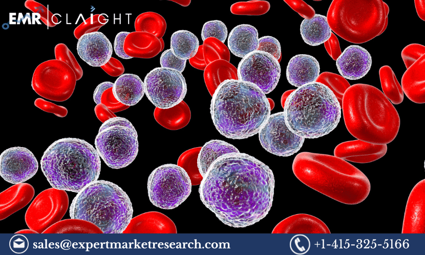 Read more about the article Global Acute Lymphocytic/Lymphoblastic Leukaemia (ALL) Therapeutics Market Size to Grow at a CAGR of 4.60% in the Forecast Period of 2024-2032