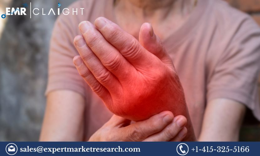 Read more about the article Global Arthralgia Management Market Size, Share, Price, Trends, Growth, Analysis,  Report and Forecast 2024-2032