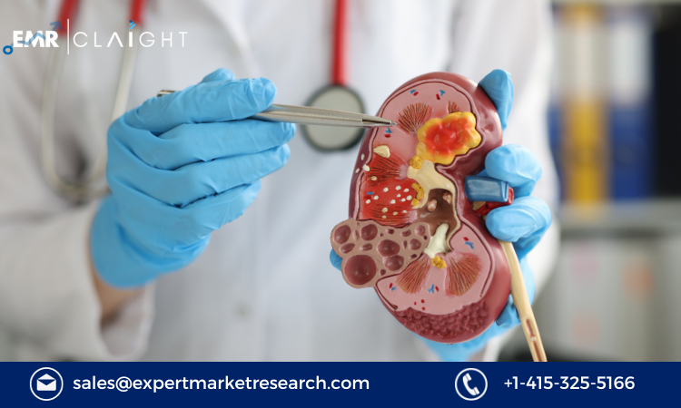 You are currently viewing Chronic Renal Failure Therapeutic Market Size, Trends, Share, Growth, Report and Forecast 2024-2032