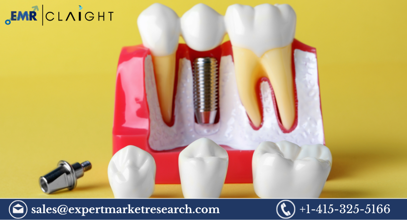 Read more about the article Global Dental Implant Abutment Systems Market Size, Share, Price, Growth, Analysis, Report and Forecast 2024-2032