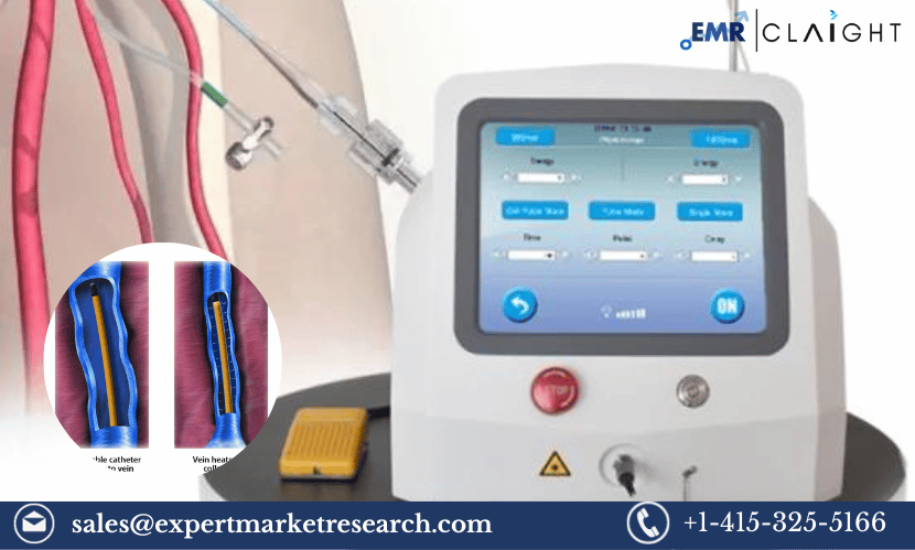 Read more about the article Global Endovenous Ablation Devices Market Share, Size, Trends, Growth, Research Report and Forecast 2024-2032