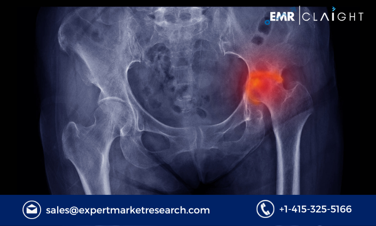 Read more about the article Femoral Head Prostheses Market Size, Share, Growth, Report and Forecast 2024-2032