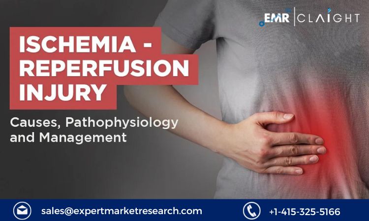 Read more about the article Ischemia Reperfusion Injury Therapeutics Market Size, Share Report and Forecast 2024-2032