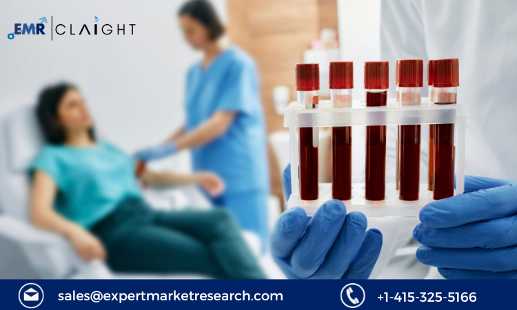 Read more about the article Lipase Testing Market Size, Share, Growth, Report and Forecast 2024-2032