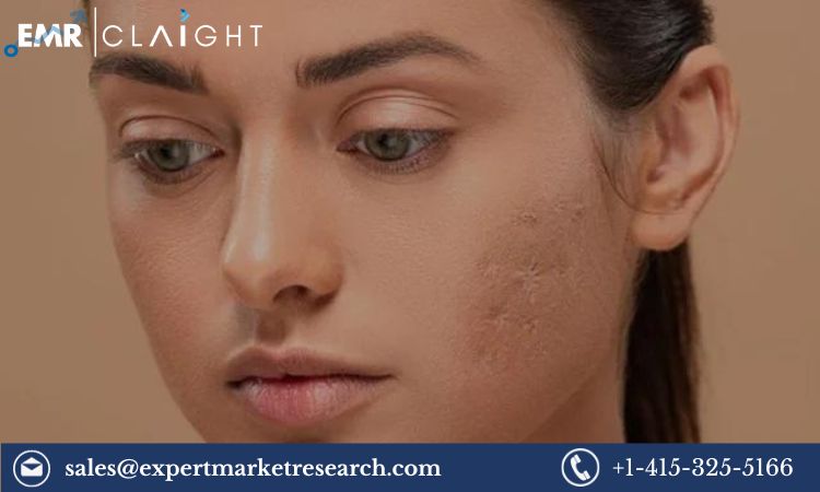 Read more about the article Global Scar Treatment Market Size, Share Report and Forecast 2024-2032