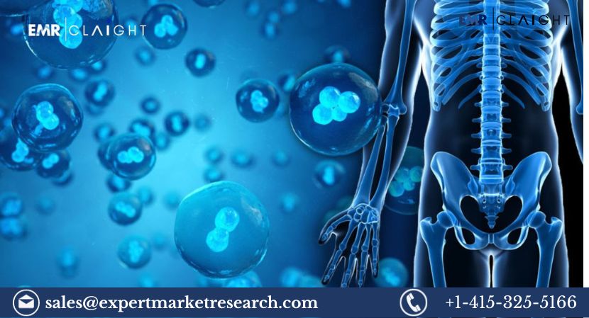 Read more about the article Global Stem Cell Therapy Market Share, Size Report and Forecast 2024-2032