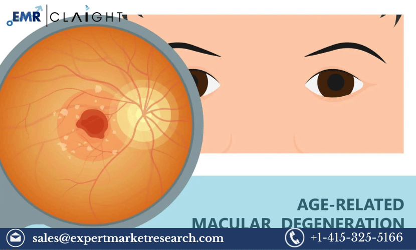 Read more about the article Global Age-Related Macular Degeneration (AMD) Market Share, Size, Trends, Growth, Outlook, Research Report and Forecast 2024-2032