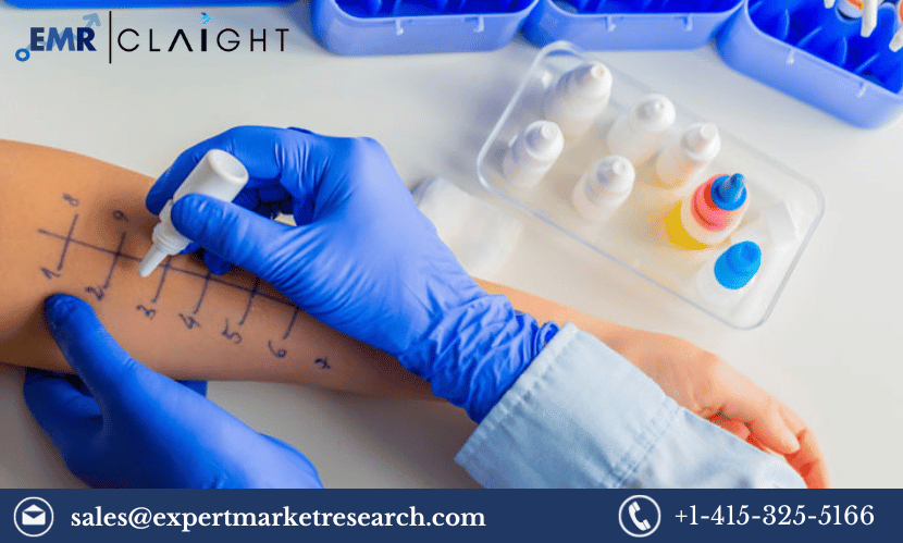 Global Allergy Diagnostics And Therapeutics Market Share Size Trends   Allergy Diagnostics And Therapeutics Market 