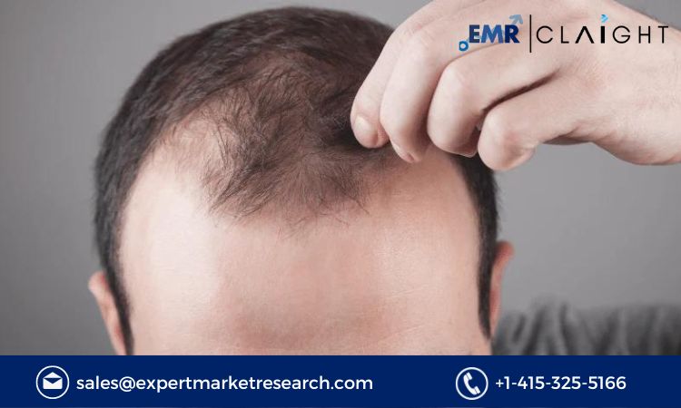 Read more about the article Alopecia Market Size, Share, Trends, Report and Forecast 2024-2032