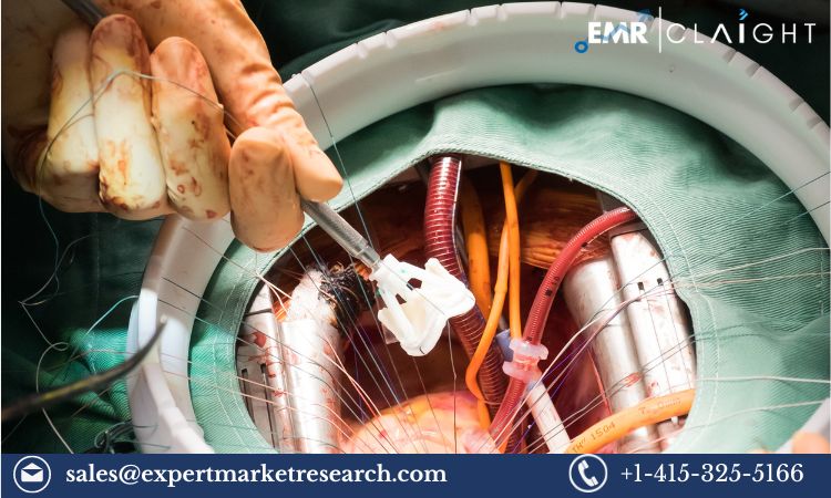 Read more about the article Global Aortic Valve Replacement Market Size, Share, Report and Forecast 2024-2032