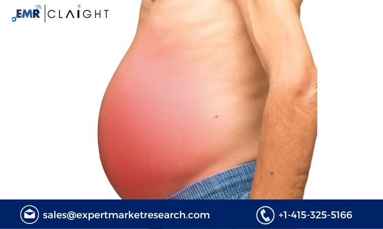 Read more about the article Global Ascites Market Size, Share, Report and Forecast 2024-2032