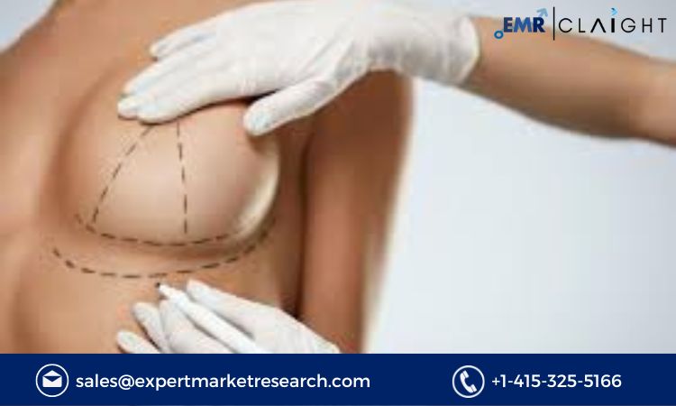 Read more about the article Global Breast Implant Market Size, Share, Report and Forecast 2024-2032