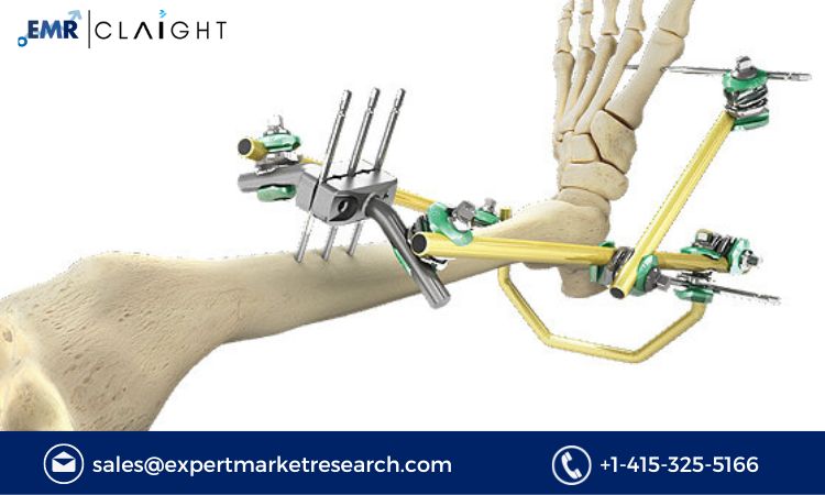 Read more about the article Global Fracture Fixation Products Market Report and Forecast 2024-2032