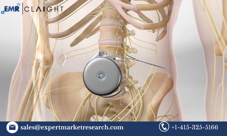 Read more about the article Global Intrathecal Pumps Market Size, Share, Price, Trends, Growth, Analysis, Report and Forecast 2024-2032