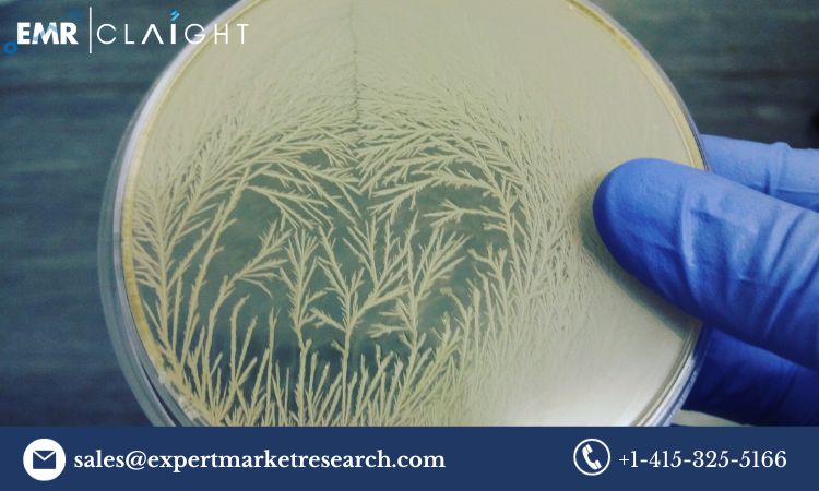 Read more about the article Global Microbial Lipase Market Trends, Growth, Size, Report, Key Players, Share, Forecast 2024-2032