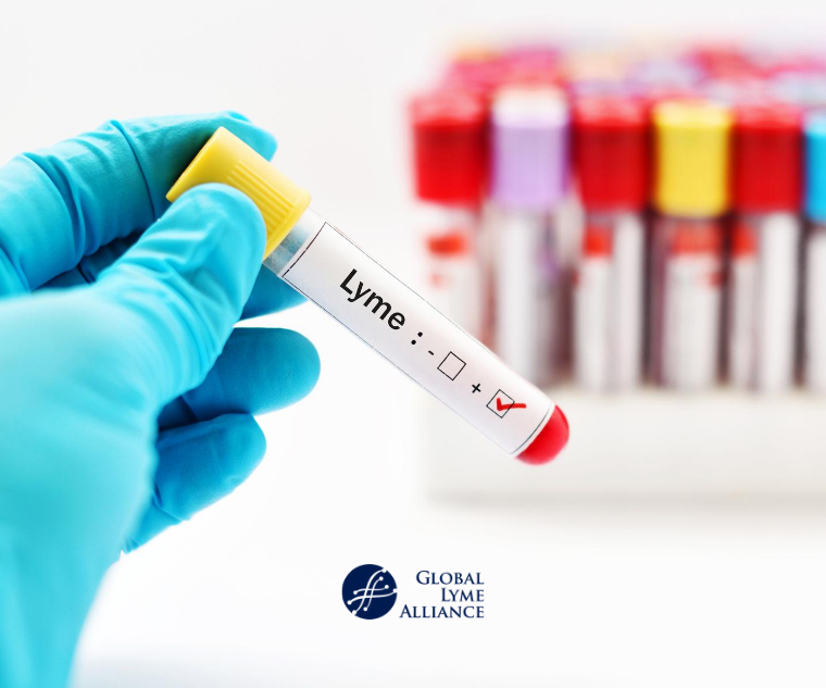 Read more about the article Lyme Disease Diagnostics Market Size, Share, Report and Forecast 2024-2032