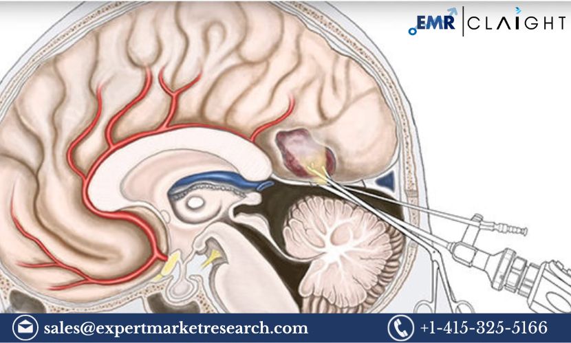 Read more about the article Global Neuroendoscopy Devices Market Size, Share, Price, Trends, Growth, Analysis, Report and Forecast 2024-2032