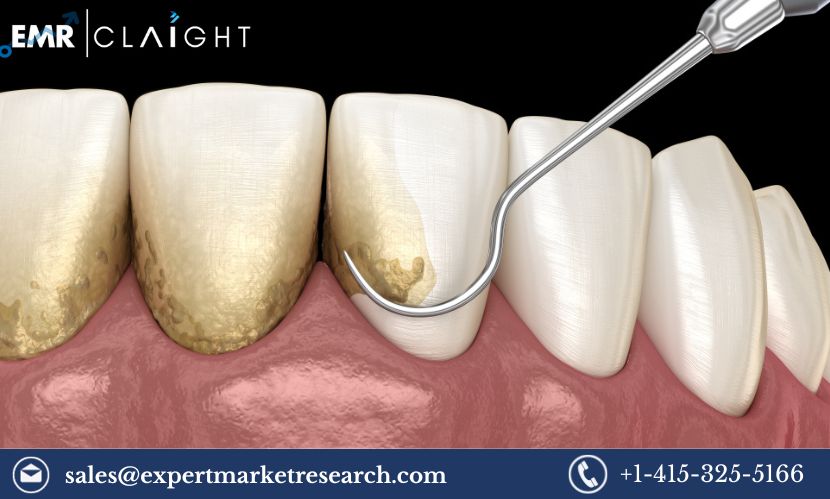 Read more about the article Global Periodontal Therapeutics Market Size, Share, Price, Trends, Growth, Analysis, Report and Forecast 2024-2032