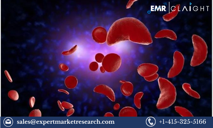 Read more about the article Sickle Cell Disease Treatment Market Size, Share, Report and Forecast 2024-2032