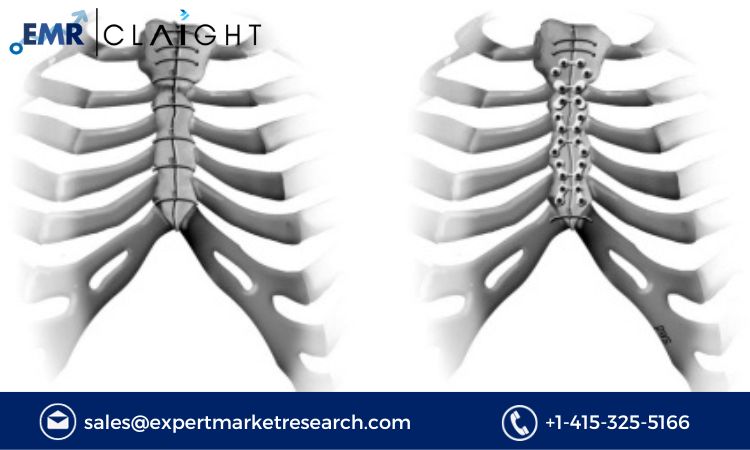 Read more about the article Global Sternal Closure Systems Market Size, Share, Report and Forecast 2024-2032