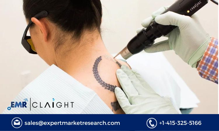 Read more about the article Global Tattoo Removal Market Size, Share, Report and Forecast 2024-2032